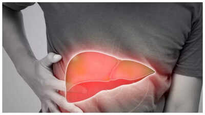 fatty liver